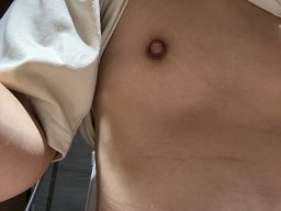 Nipple
